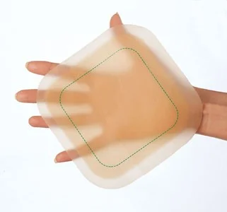 Hand holding a DuoDERM Dressing
